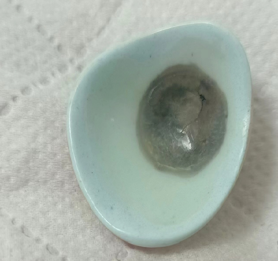 义眼片开裂还能继续佩戴吗