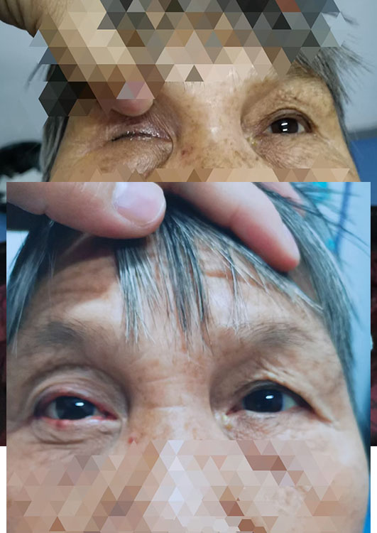 西安义眼台为视力重塑带来新希望