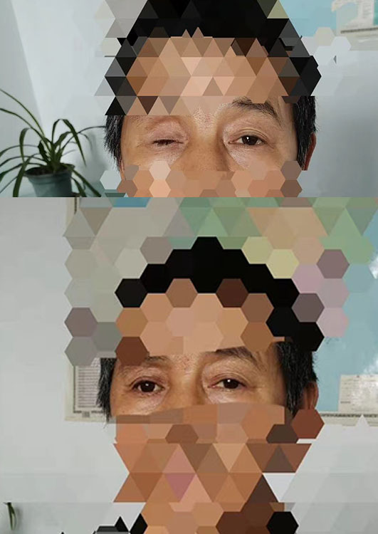 义眼工作室专业定制逼真眼球服务