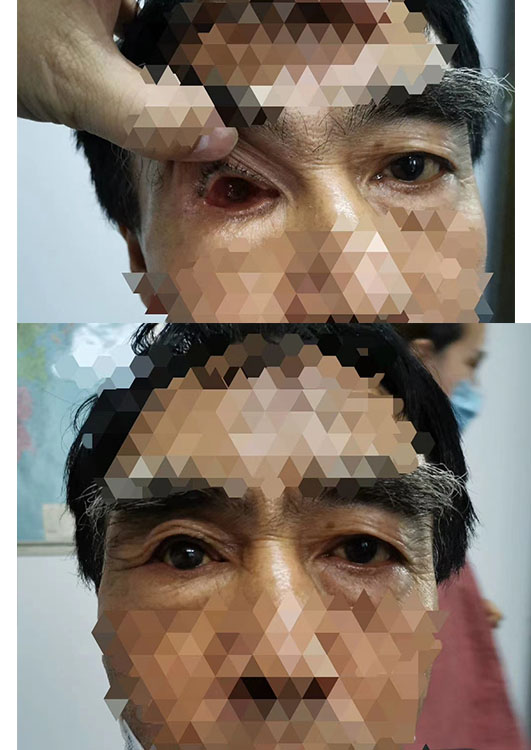 义眼线上线下买有何区别